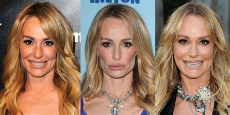 taylor armstrong|taylor armstrong before and after.